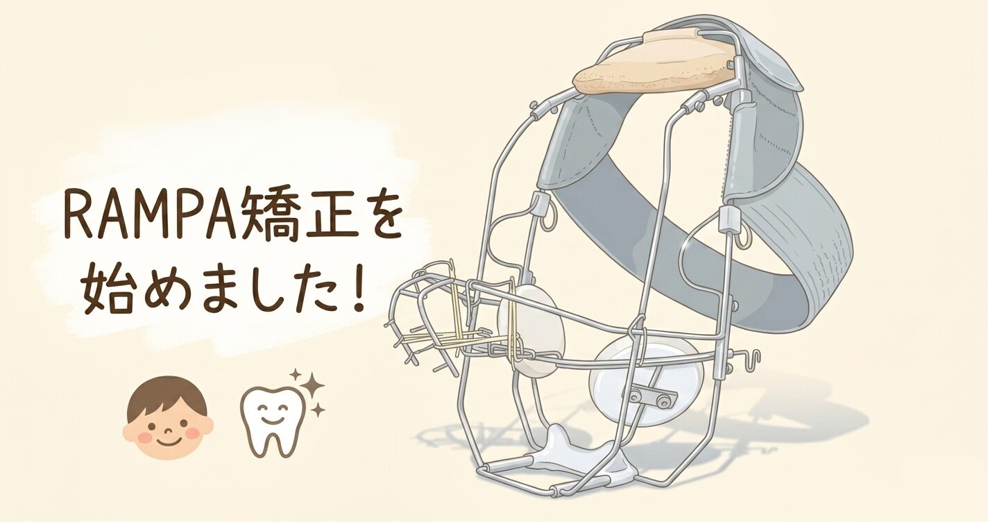 Featured image of post 子供2人をRAMPA矯正で治療した母の本音【費用・期間・大変だったこと全部書く】